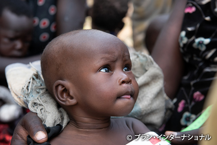 写真：食糧や栄養不良の治療を提供（南スーダン）