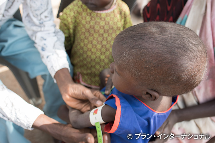 写真：発育状態のチェックを受ける南スーダンの子ども