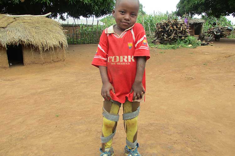 自分の脚で立てるようになった小学1年生の男の子 / ©プラン・インターナショナル