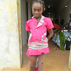 写真：モウカットさん、10歳、障がいのある女の子