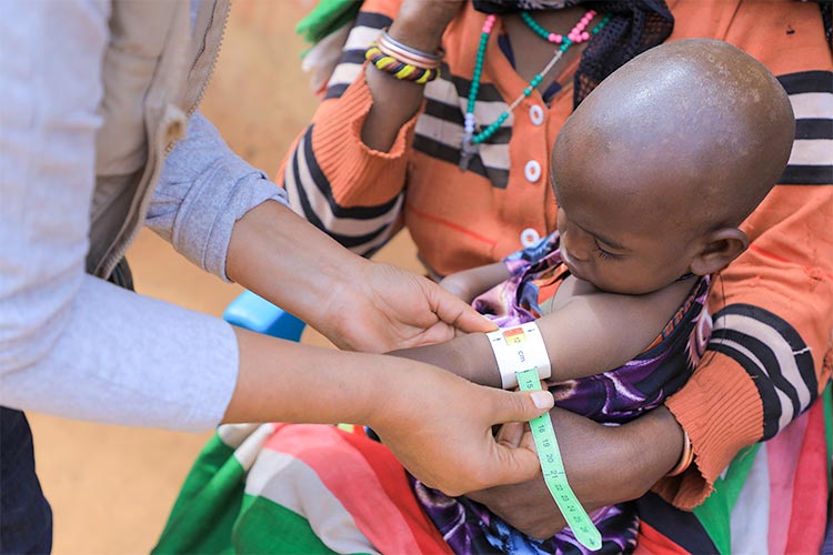 写真:写真:栄養不良の子どもを特定するプランスタッフ(エチオピア)