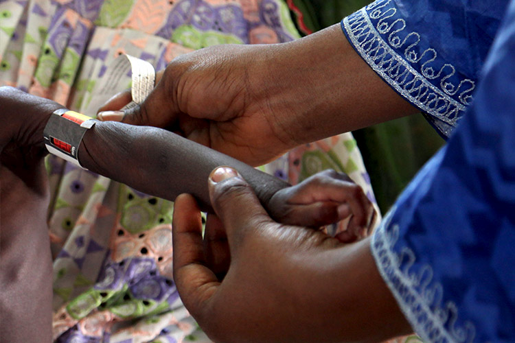 栄養不良の子どもの腕周りを図る保健スタップ（ニジェール）