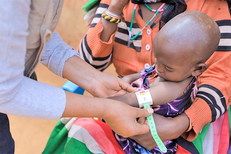 写真:赤ちゃんの栄養状態を確認する様子(エチオピア)