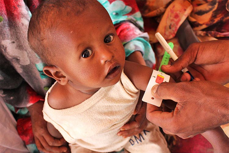 写真：2023年の募金は「食料危機下の子どもの栄養改善」プロジェクト（スーダン）に充てられました