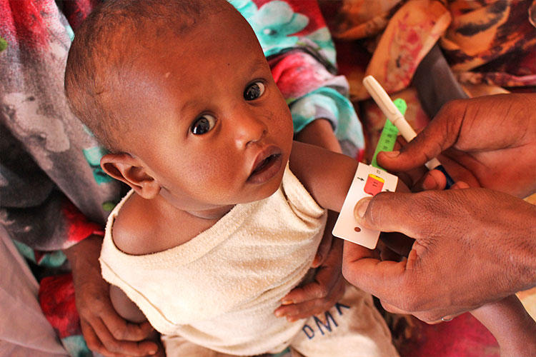「食料危機下の子どもの栄養改善」プロジェクト（スーダン）