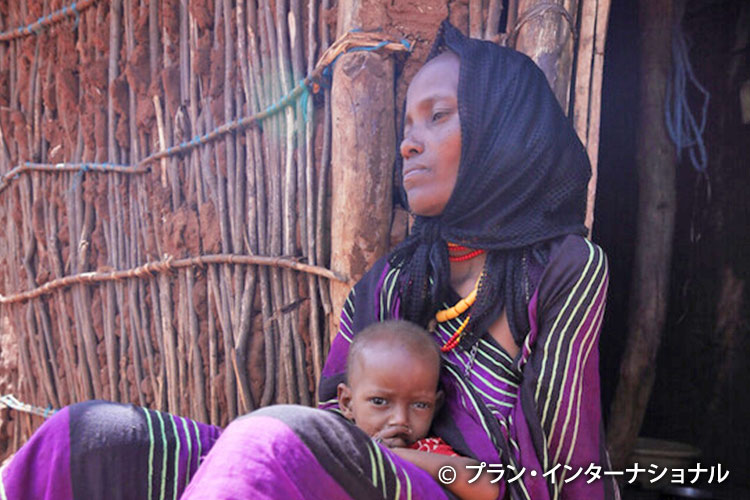 写真:子どもの栄養不良が深刻化（エチオピア）
