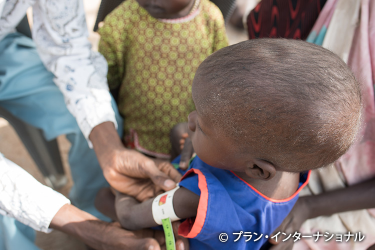写真：発育状態のチェックを受ける南スーダンの子ども